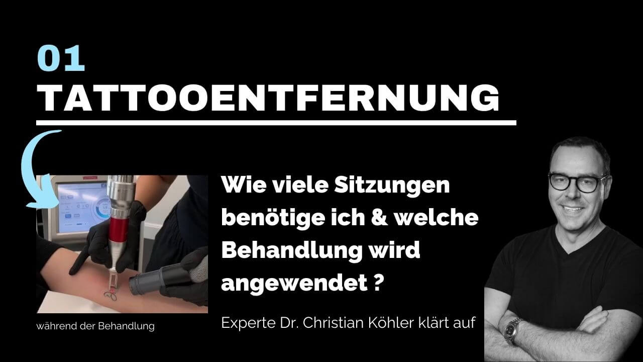 Tattooentferrnung, prevention-center für Schönheitschirurgie in Zürich & Zug